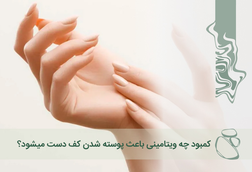 کمبود چه ویتامینی باعث پوسته شدن کف دست میشود؟